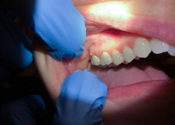 Best Emergency Dental Surgery in Atoka, NM