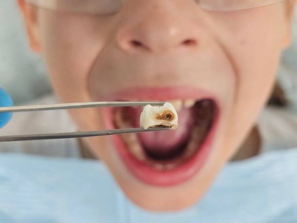 Best Emergency Treatment for Toothache in Atoka, NM